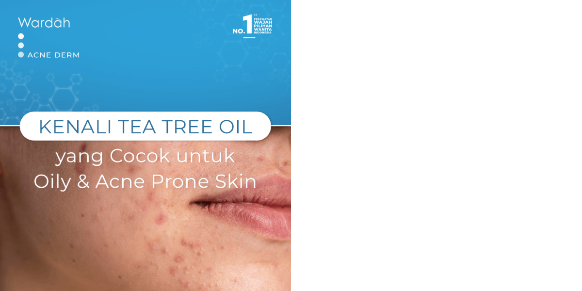 apa-itu-tea-tree-oil-ternyata-cocok-untuk-oily-dan-acne-prone-skin
